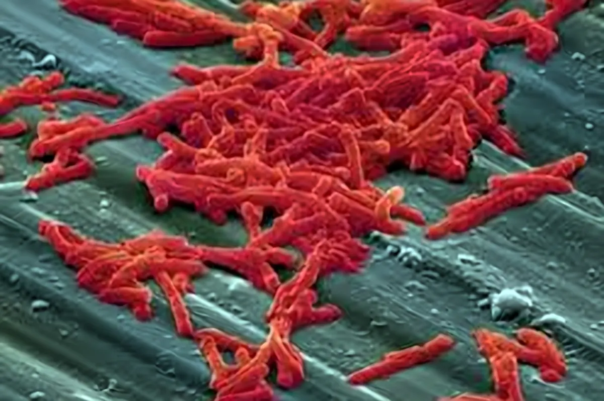 Microbiology Culture Media